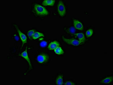 TNFRSF10A / DR4 Antibody - Immunofluorescent analysis of A549 cells at a dilution of 1:100 and Alexa Fluor 488-congugated AffiniPure Goat Anti-Rabbit IgG(H+L)