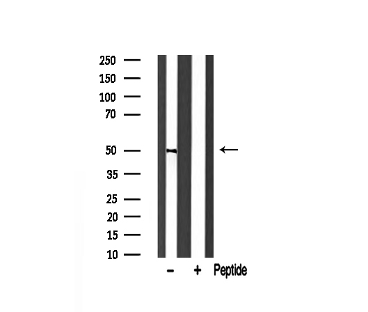 TNFRSF10A / DR4 Antibody - Western blot analysis of TR10A expression in rat spleen lysate