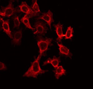 TNFRSF10A / DR4 Antibody - Staining HeLa cells by IF/ICC. The samples were fixed with PFA and permeabilized in 0.1% Triton X-100, then blocked in 10% serum for 45 min at 25°C. The primary antibody was diluted at 1:200 and incubated with the sample for 1 hour at 37°C. An Alexa Fluor 594 conjugated goat anti-rabbit IgG (H+L) Ab, diluted at 1/600, was used as the secondary antibody.