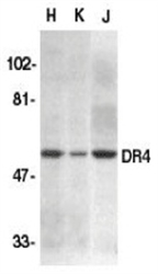 TNFRSF10A / DR4 Antibody - Western blot analysis for whole cell lysates from HeLa (H), K562 (K0 and Jurkat (J) cell lines probed with Rabbit anti-Human CD261 (RABBIT ANTI HUMAN CD261 (N-TERMINAL)).