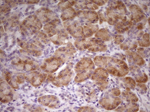TNFRSF10B / Killer / DR5 Antibody - Immunohistochemical staining of paraffin-embedded Human pancreas tissue within the normal limits using anti-TNFRSF10B mouse monoclonal antibody. (Heat-induced epitope retrieval by 1 mM EDTA in 10mM Tris, pH8.5, 120C for 3min,