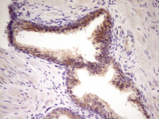 TNFRSF10B / Killer / DR5 Antibody - Immunohistochemical staining of paraffin-embedded Human prostate tissue within the normal limits using anti-TNFRSF10B mouse monoclonal antibody. (Heat-induced epitope retrieval by 1 mM EDTA in 10mM Tris, pH8.5, 120C for 3min,