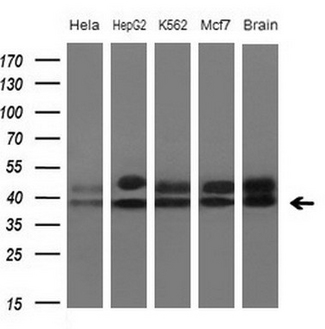 TNFRSF10B / Killer / DR5 Antibody - Western blot analysis of extracts. (10ug) from 4 different cell lines and 1 human tissue by using anti-TNFRSF10B monoclonal antibody at 1:200 dilution.