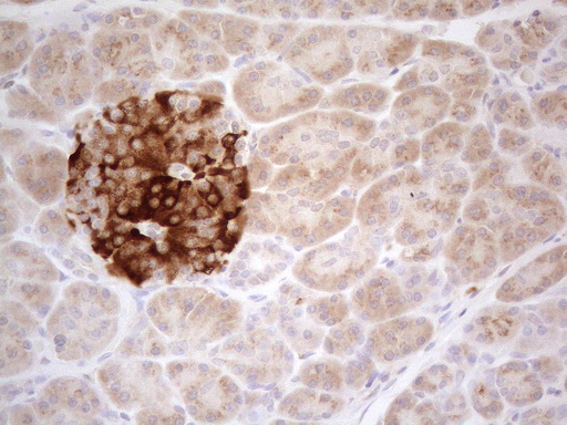 TNFRSF10B / Killer / DR5 Antibody - Immunohistochemical staining of paraffin-embedded Human pancreas tissue using anti-TNFRSF10B mouse monoclonal antibody. (Heat-induced epitope retrieval by 1mM EDTA in 10mM Tris buffer. (pH8.5) at 120°C for 3 min. (1:150)