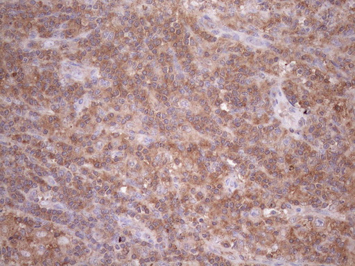 TNFRSF10B / Killer / DR5 Antibody - Immunohistochemical staining of paraffin-embedded Human lymph node tissue using anti-TNFRSF10B mouse monoclonal antibody. (Heat-induced epitope retrieval by 1mM EDTA in 10mM Tris buffer. (pH8.5) at 120°C for 3 min. (1:150)