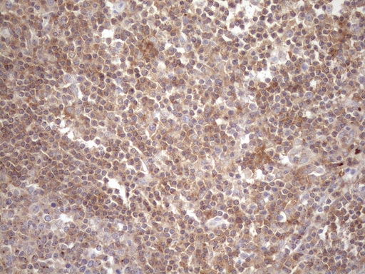 TNFRSF10B / Killer / DR5 Antibody - Immunohistochemical staining of paraffin-embedded Human tonsil using anti-TNFRSF10B mouse monoclonal antibody. (Heat-induced epitope retrieval by 1mM EDTA in 10mM Tris buffer. (pH8.5) at 120°C for 3 min. (1:150)
