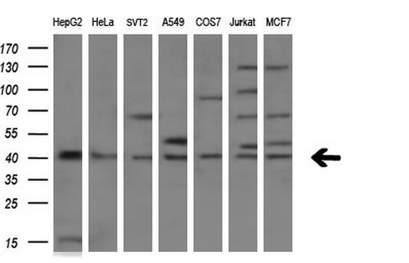 TNFRSF10B / Killer / DR5 Antibody - Western blot analysis of extracts. (10ug) from 7 different cell lines by using anti-TNFRSF10B monoclonal antibody. (1:200)