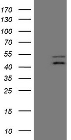 TNFRSF10B / Killer / DR5 Antibody - HEK293T cells were transfected with the pCMV6-ENTRY control. (Left lane) or pCMV6-ENTRY TNFRSF10B. (Right lane) cDNA for 48 hrs and lysed