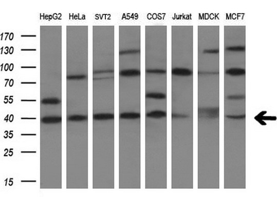 TNFRSF10B / Killer / DR5 Antibody - Western blot analysis of extracts. (10ug) from 8 different cell lines by using anti-TNFRSF10B monoclonal antibody. (1:200)