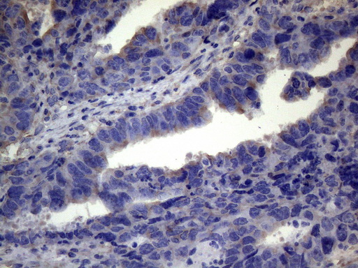 TNFRSF10B / Killer / DR5 Antibody - Immunohistochemical staining of paraffin-embedded Human Ovary tissue within the normal limits using anti-TNFRSF10B mouse monoclonal antibody. (Heat-induced epitope retrieval by 1mM EDTA in 10mM Tris buffer. (pH8.5) at 120°C for 3 min. (1:150)