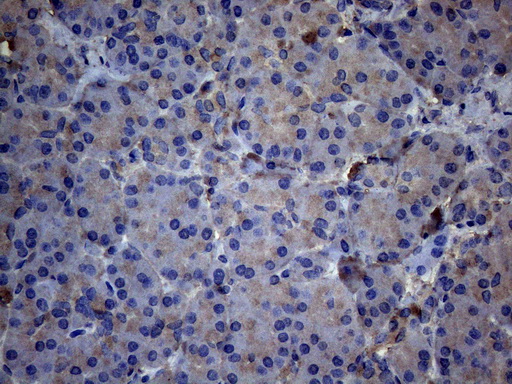 TNFRSF10B / Killer / DR5 Antibody - Immunohistochemical staining of paraffin-embedded Human pancreas tissue within the normal limits using anti-TNFRSF10B mouse monoclonal antibody. (Heat-induced epitope retrieval by 1mM EDTA in 10mM Tris buffer. (pH8.5) at 120°C for 3 min. (1:150)