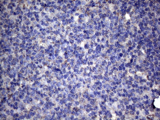 TNFRSF10B / Killer / DR5 Antibody - Immunohistochemical staining of paraffin-embedded Human tonsil within the normal limits using anti-TNFRSF10B mouse monoclonal antibody. (Heat-induced epitope retrieval by 1mM EDTA in 10mM Tris buffer. (pH8.5) at 120°C for 3 min. (1:150)