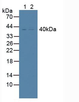 TNFRSF10B / Killer / DR5 Antibody - Western Blot; Sample: Lane1: Human K562 Cells; Lane2: Human Lung Tissue.
