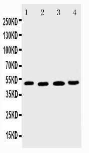 TNFRSF10B / Killer / DR5 Antibody - WB of TNFRSF10B / Killer / DR5 antibody. All lanes: Anti-TNFRSF10B at 0.5ug/ml. Lane 1: HELA Whole Cell Lysate at 40ug. Lane 2: MM231 Whole Cell Lysate at 40ug. Lane 3: SGC Whole Cell Lysate at 40ug. Lane 4: HT1080 Whole Cell Lysate at 40ug. Predicted bind size: 48KD. Observed bind size: 48KD.