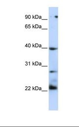 TNFRSF10B / Killer / DR5 Antibody - 721_B cell lysate. Antibody concentration: 1.0 ug/ml. Gel concentration: 12%.  This image was taken for the unconjugated form of this product. Other forms have not been tested.