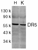 TNFRSF10B / Killer / DR5 Antibody - Western blot analysis of DR5 in HeLa (H) and K562 (K) cell lysates with DR5 antibody at 2 g/ml.