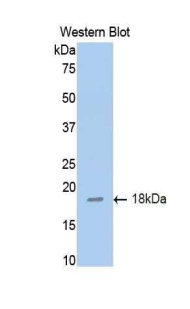 TNFRSF10B / Killer / DR5 Antibody - Western blot of recombinant TNFRSF10B / Killer / DR5.  This image was taken for the unconjugated form of this product. Other forms have not been tested.