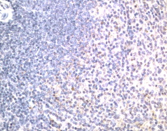 TNFRSF10B / Killer / DR5 Antibody - IHC of Killer / DR5 antibody. Human spleen.