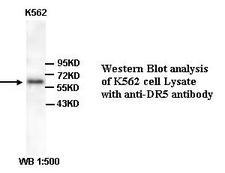 TNFRSF10B / Killer / DR5 Antibody