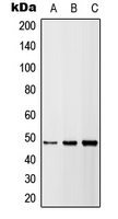 TNFRSF10B / Killer / DR5 Antibody - Western blot analysis of DR5 expression in HEK293T (A); A549 (B); H9C2 (C) whole cell lysates.