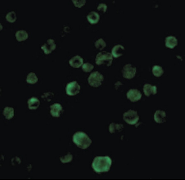 TNFRSF10B / Killer / DR5 Antibody - Immunofluorescence of DR5 in HeLa cells with DR5 antibody at 20 ug/ml.