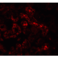 TNFRSF10B / Killer / DR5 Antibody - Immunofluorescence of DR5 in mouse kidney tissue with DR5 Antibody at 20 µg/mL.