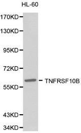 TNFRSF10B / Killer / DR5 Antibody - Western blot of TNFRSF10B pAb in extracts from HL-60 cells.