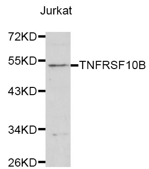 TNFRSF10B / Killer / DR5 Antibody - Western blot analysis of extracts of Jurkat cells, using TNFRSF10B antibody at 1:1000 dilution. The secondary antibody used was an HRP Goat Anti-Rabbit IgG (H+L) at 1:10000 dilution. Lysates were loaded 25ug per lane and 3% nonfat dry milk in TBST was used for blocking.