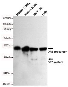 TNFRSF10B / Killer / DR5 Antibody - Western blot detection of DR5 in Mouse kidney, Mouse brain, HCT116 and HeLa cell lysates using DR5 mouse monoclonal antibody (1:500-1:2000 dilution). Predicted band size: 40/48KDa. Observed band size:40/48KDa.