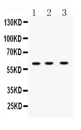 TNFRSF10B / Killer / DR5 Antibody - Western blot - Anti-DR5 Picoband Antibody