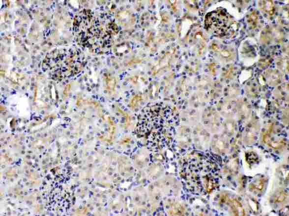 TNFRSF10B / Killer / DR5 Antibody - DR5 was detected in paraffin-embedded sections of rat kidney tissues using rabbit anti- DR5 Antigen Affinity purified polyclonal antibody