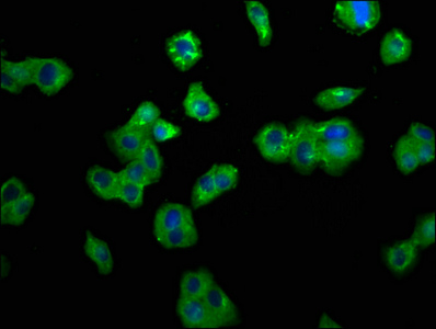 TNFRSF10B / Killer / DR5 Antibody - Immunofluorescence staining of HepG2 cells diluted at 1:200,counter-stained with DAPI. The cells were fixed in 4% formaldehyde, permeabilized using 0.2% Triton X-100 and blocked in 10% normal Goat Serum. The cells were then incubated with the antibody overnight at 4°C.The Secondary antibody was Alexa Fluor 488-congugated AffiniPure Goat Anti-Rabbit IgG (H+L).