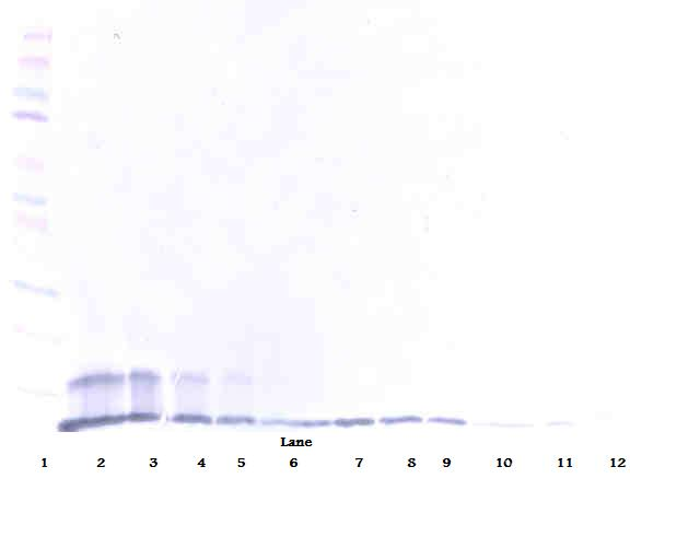 TNFRSF10B / Killer / DR5 Antibody - Anti-Human sTRAIL Receptor-2 Western Blot Reduced