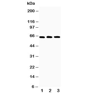 TNFRSF11A / RANK Antibody - Western blot testing of RANK antibody and Lane 1: Recombinant human RANK protein 10ng; 2: 5ng; 3: 2.5ng