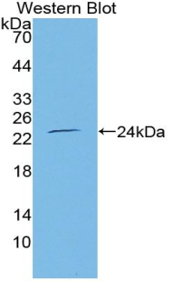 TNFRSF11A / RANK Antibody - Western blot of recombinant TNFRSF11A / RANK.