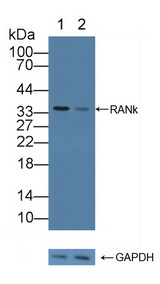 TNFRSF11A / RANK Antibody - Knockout Varification: Lane 1: Wild-type 293T cell lysate; Lane 2: RANk knockout 293T cell lysate; Predicted MW: 28,32,36,56,65kd Observed MW: 35kd Primary Ab: 1µg/ml Rabbit Anti-Human RANk Antibody Second Ab: 0.2µg/mL HRP-Linked Caprine Anti-Rabbit IgG Polyclonal Antibody