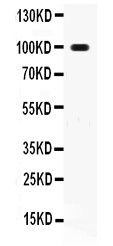 TNFRSF11A / RANK Antibody - RANK antibody Western blot. All lanes: Anti RANK at 0.5 ug/ml. WB: HEPA Whole Cell Lysate at 40 ug. Predicted band size: 66 kD. Observed band size: 100 kD.