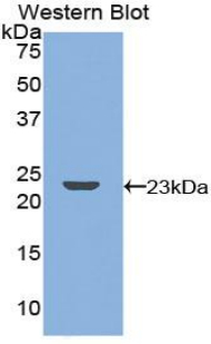 TNFRSF11A / RANK Antibody - Western blot of recombinant TNFRSF11A / RANK.  This image was taken for the unconjugated form of this product. Other forms have not been tested.