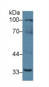 TNFRSF11A / RANK Antibody - Western Blot; Sample: Mouse Liver lysate; Primary Ab: 2µg/ml Rabbit Anti-Mouse RANk Antibody Second Ab: 0.2µg/mL HRP-Linked Caprine Anti-Rabbit IgG Polyclonal Antibody