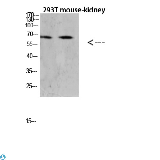 TNFRSF11A / RANK Antibody - Western blot analysis of 293T and mouse kidney lysate, antibody was diluted at 1000. Secondary antibody was diluted at 1:20000.