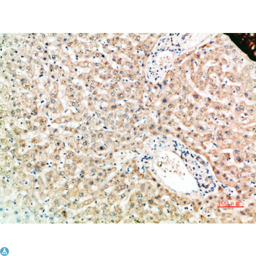 TNFRSF11A / RANK Antibody - Immunohistochemical analysis of paraffin-embedded human-liver, antibody was diluted at 1:200.