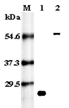 TNFRSF11A / RANK Antibody - Western blot analysis using anti-RANK (human), pAb at 1:5,000 dilution. 1: Recombinant human RANK (His-tagged). 2: Human RANK (Fc protein).