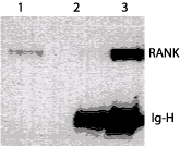 TNFRSF11A / RANK Antibody - Detection of RANK in RAW cells. Lane 1. Western blot detection of RANK in RAW, a mouse cell line. Lane 2 & 3. IP/Western blot of RANK. RANK protein from RAW cell lysate was immunoprecipitated either with control antibody (lane 2) or IMG-325 (lane 3), the immunoprecipitated proteins were resolved on SDS-PAGE. RANK was detected by Western blot of IMG-325 antibody.