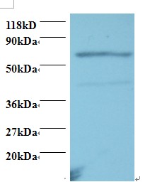 TNFRSF11A / RANK Antibody - Western blot of Tumor necrosis factor receptor superfamily member 11A antibody at 2 ug/ml. Lane 1: EC109 whole cell lysate. Lane 2: 293T whole cell lysate. Secondary: Goat polyclonal to Rabbit IgG at 1:15000 dilution. Predicted band size: 67 kDa. Observed band size: 67 kDa Additional bands at: 43 kDa. We are unsure as to the identity of this extra band.  This image was taken for the unconjugated form of this product. Other forms have not been tested.