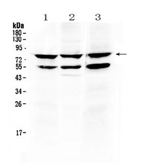 TNFRSF11A / RANK Antibody - Western blot - Anti-RANK Picoband Antibody