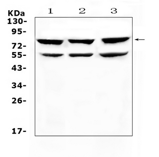 TNFRSF11A / RANK Antibody - Western blot analysis of RANK using anti-RANK antibody. Electrophoresis was performed on a 5-20% SDS-PAGE gel at 70V (Stacking gel) / 90V (Resolving gel) for 2-3 hours. The sample well of each lane was loaded with 50ug of sample under reducing conditions. Lane 1: rat thymus tissue lysates, Lane 2: mouse thymus tissue lysates, Lane 3: HEPG2 whole Cell lysates. After Electrophoresis, proteins were transferred to a Nitrocellulose membrane at 150mA for 50-90 minutes. Blocked the membrane with 5% Non-fat Milk/ TBS for 1.5 hour at RT. The membrane was incubated with rabbit anti-RANK antigen affinity purified polyclonal antibody at 0.5 µg/mL overnight at 4°C, then washed with TBS-0.1% Tween 3 times with 5 minutes each and probed with a goat anti-rabbit IgG-HRP secondary antibody at a dilution of 1:10000 for 1.5 hour at RT. The signal is developed using an Enhanced Chemiluminescent detection (ECL) kit with Tanon 5200 system. A specific band was detected for RANK at approximately 80KD. The expected band size for RANK is at 66KD.