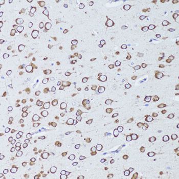 TNFRSF11A / RANK Antibody - Immunohistochemistry of paraffin-embedded mouse brain using TNFRSF11A antibody at dilution of 1:100 (20x lens).