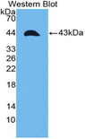 TNFRSF12A / TWEAK Receptor Antibody - Western blot of TNFRSF12A / TWEAK Receptor antibody.