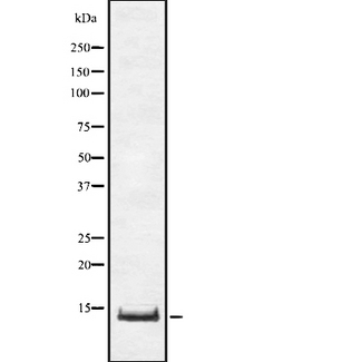 TNFRSF12A / TWEAK Receptor Antibody - Western blot analysis of TNFRSF12A using COLO205 whole cells lysates