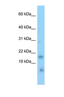 TNFRSF12A / TWEAK Receptor Antibody - TNFRSF12A / TWEAKR antibody Western blot of Mouse Kidney lysate. Antibody concentration 1 ug/ml.  This image was taken for the unconjugated form of this product. Other forms have not been tested.